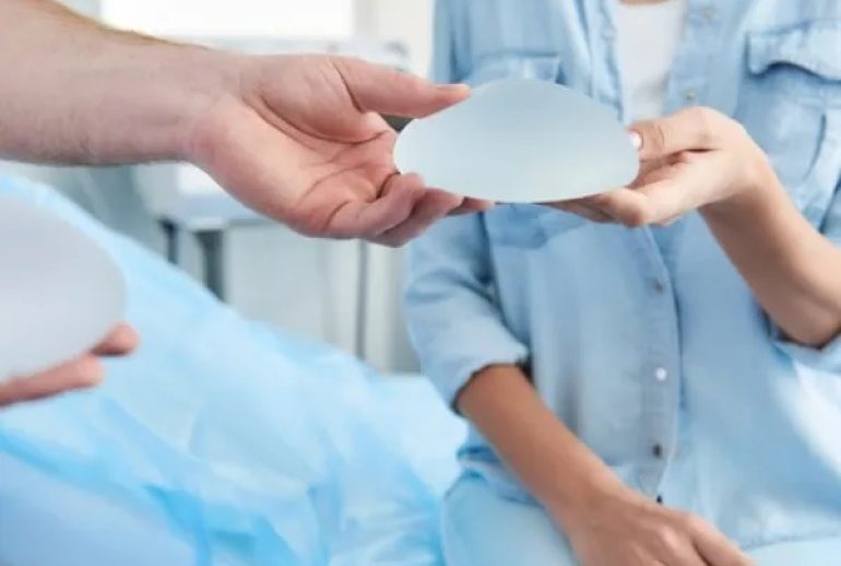 دکتر ایمپلنت سینه - مشهد