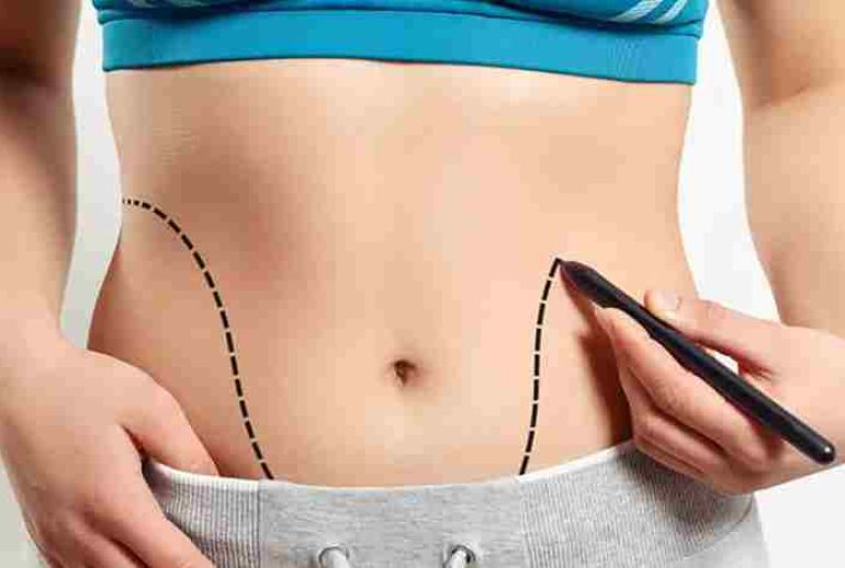 دکتر لیپوماتیک - شیراز